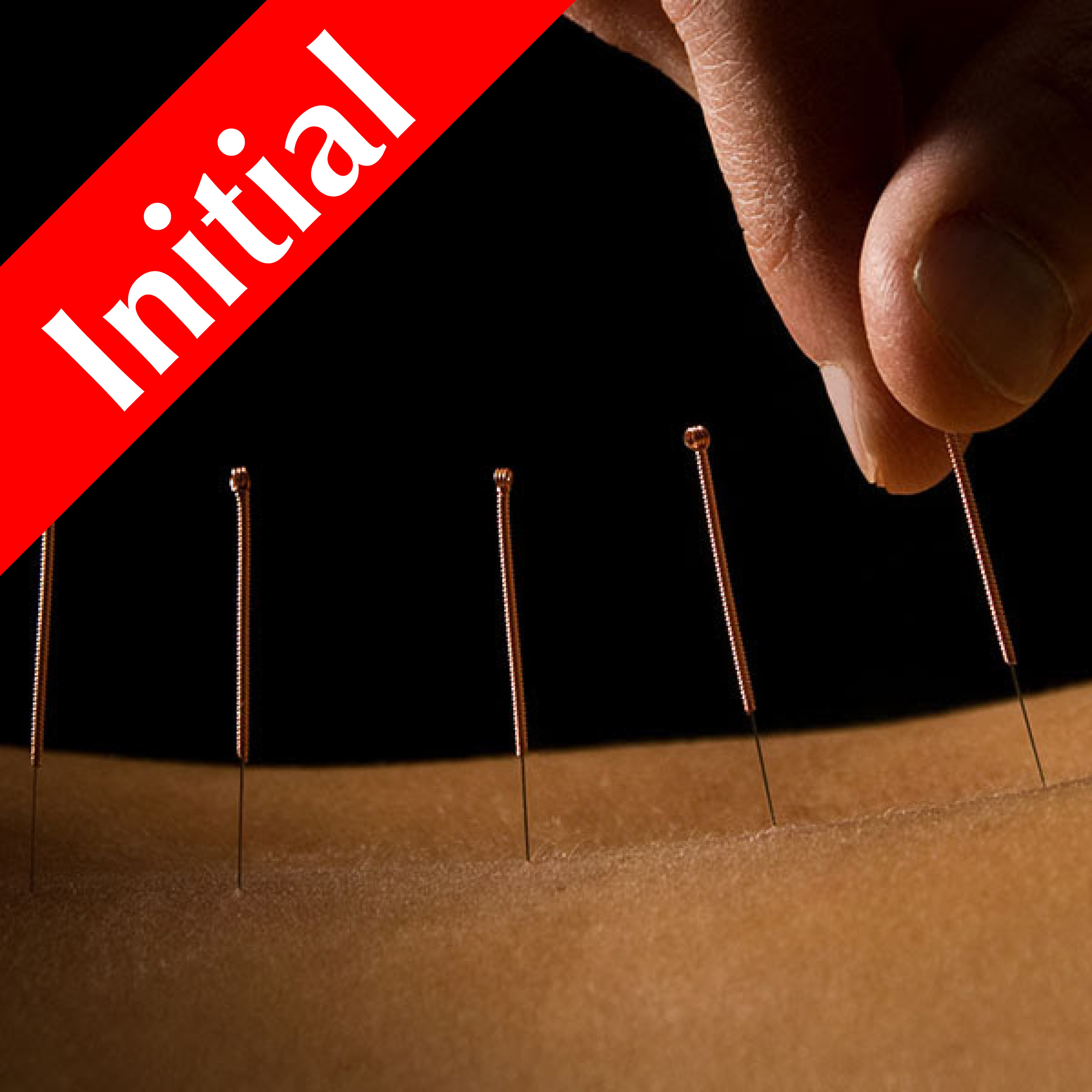 60 Minute Initial Acupuncture Session Health In The Bay